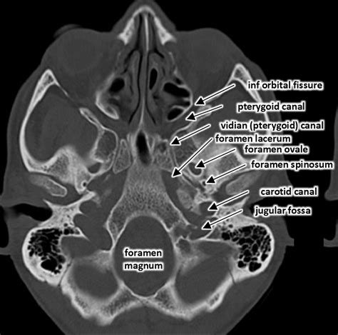 Pin by Nancy Otero on CT education in 2024 | Medical radiography, Radiology imaging, Radiology