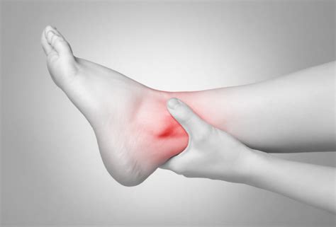 Common Gout Flare-up Triggers » Healthfocus