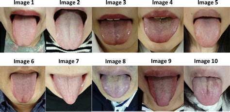 Frontiers | Objective evaluation of tongue diagnosis ability using a tongue diagnosis e-learning ...