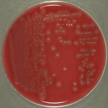 Clostridium perfringens