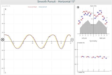 VisualEyes™ | Smooth Pursuit Eye Movement Testing | Interacoustics