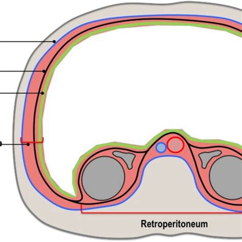 (PDF) Extraperitoneal Space: Anatomic and Radiologic Overview