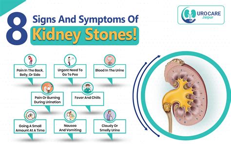 8 Signs and Symptoms of Kidney Stones!