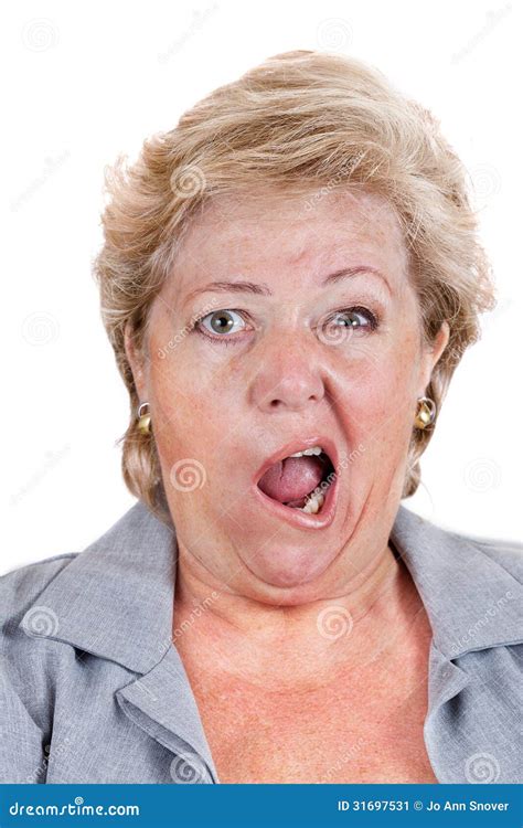 Bell S Palsy - Lopsided Screaming Stock Image - Image of jacket, neurological: 31697531