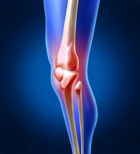 Knee injuries - Answers on HealthTap