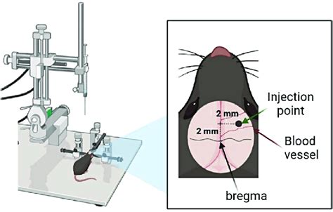 Schematic image of stereotaxic surgery for the injection brain tumor... | Download Scientific ...