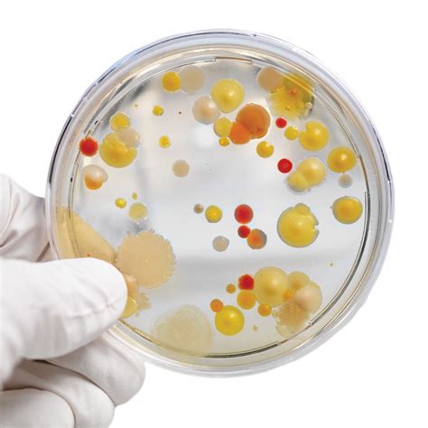 Free photo: Bacteria Growing - Analysis, Petri, Life - Free Download ...