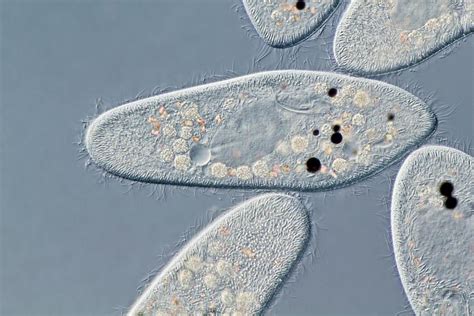 Paramecium Protozoa Photograph by Gerd Guenther/science Photo Library ...