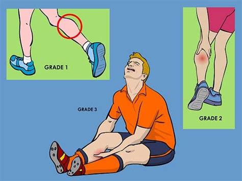 Calf Strain Symptoms - Muscle Pull | Muscle Pull