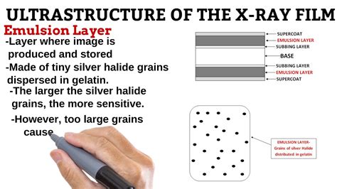 8. Layers of the X-Ray Film RADIOGRAPHIC IMAGING - YouTube