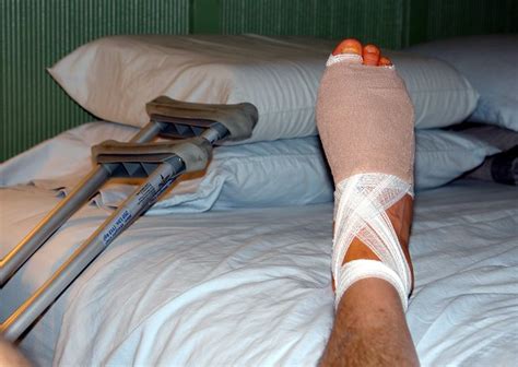 Cheilectomy Surgery Day 1 | Flickr - Photo Sharing!