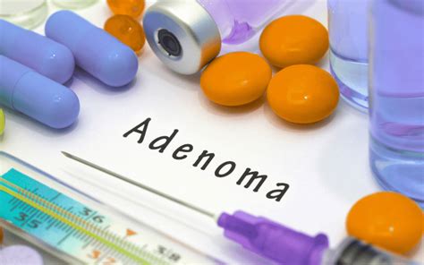 10 Telltale Symptoms of Pleomorphic Adenoma: What You Must Know