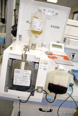 Apheresis machine - Stock Image - C001/3389 - Science Photo Library