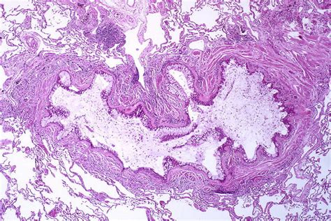 Respiratory Adjustments | Boundless Anatomy and Physiology