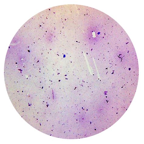 Prepared Slides, Bacteria Smear, Each American Scientific