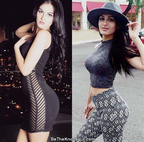 SSSniperwolf Plastic Surgery Comparison Photos