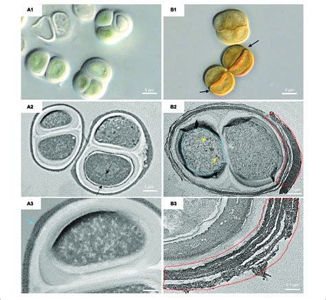 | DIC microscopy and TEM images from UAM816. Series A: Cells and... | Download Scientific Diagram