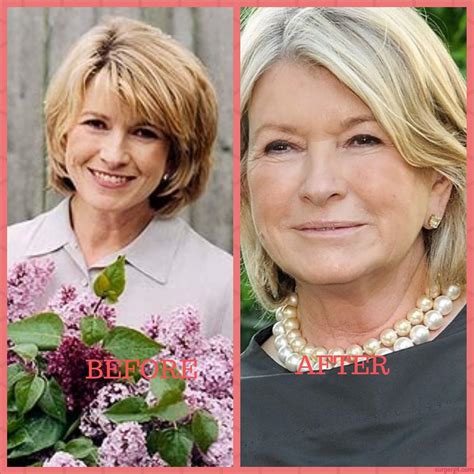 Martha Stewart Plastic Surgery Photos [Before & After] ⋆ Surgery4