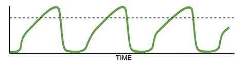 Capnography Waveform