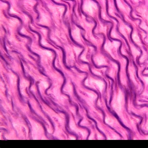 dense elastic connective tissue | Human tissue, Integumentary system, Biology lessons