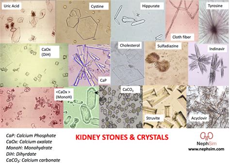 Case 32: Diagnosis & Conclusions