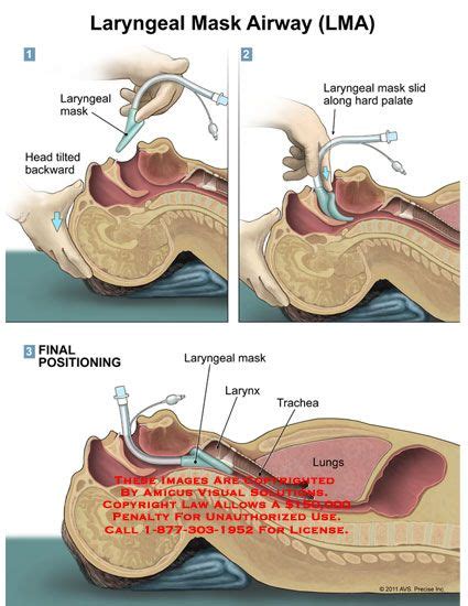 Pin on ACLS prep