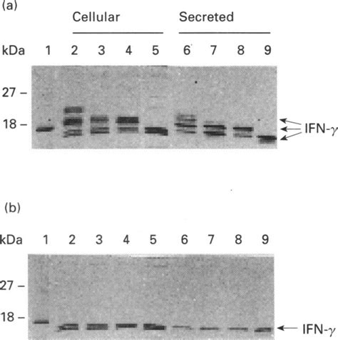 Synthesis of recombinant IFN-y by baculovirus-infected St9 cells... | Download Scientific Diagram