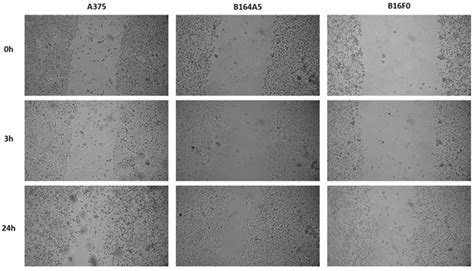 Images of melanoma cell lines, A375, B164A5 and B16F0, from the ...