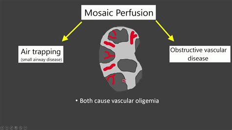 Mosaic Attenuation - YouTube