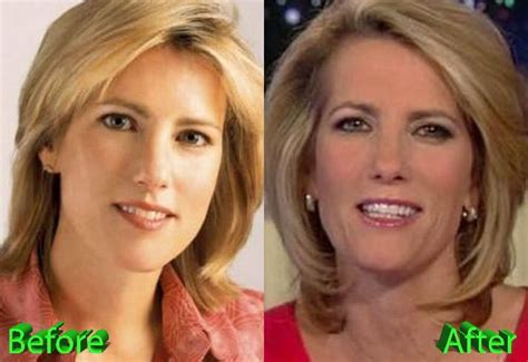 Laura Ingraham Plastic Surgery: Nothing More Than A Gossip? - Celebrity ...