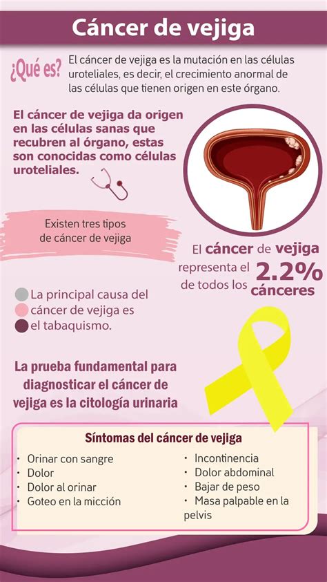 Clasificación Del Cáncer De Vejiga