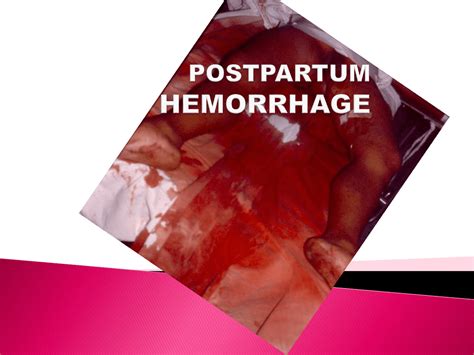 Pathophysiology Of Postpartum Hemorrhage