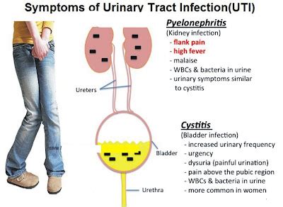 Symptoms of Urinary Tract Infection (UTI) | Medical Study Stuff