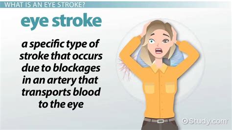 Can An Eye Stroke Trigger A Brain Stroke? Exploring The Connection