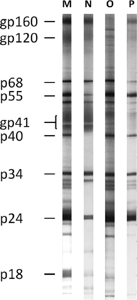 Hiv Western Blot Test