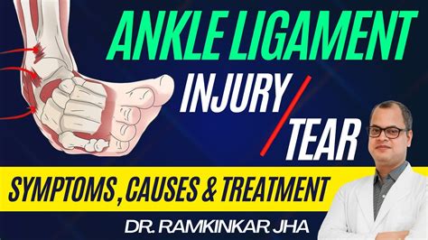 Ankle ATFL Ligament Tear/ Injury Causes, Symptoms and Treatment - YouTube