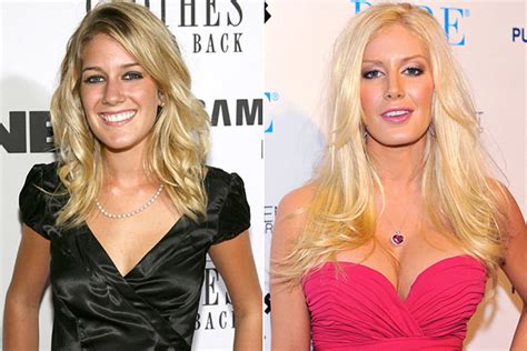 Celebrities' Plastic Surgery: See Before and After Photos