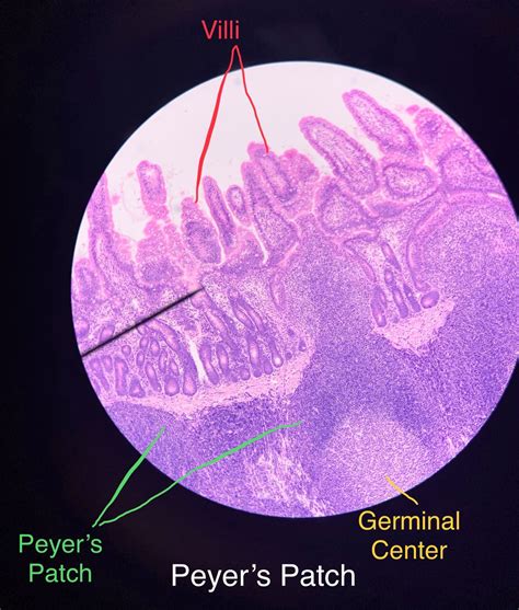 Peyer's Patch Histology.