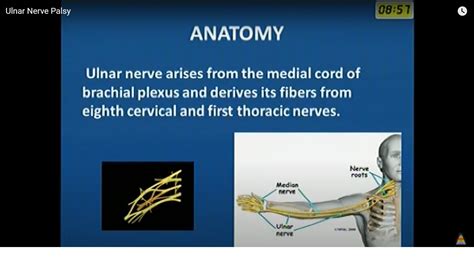 Ulnar Nerve Clinical Examination Orthopaedicprinciplescom Images – NBKomputer