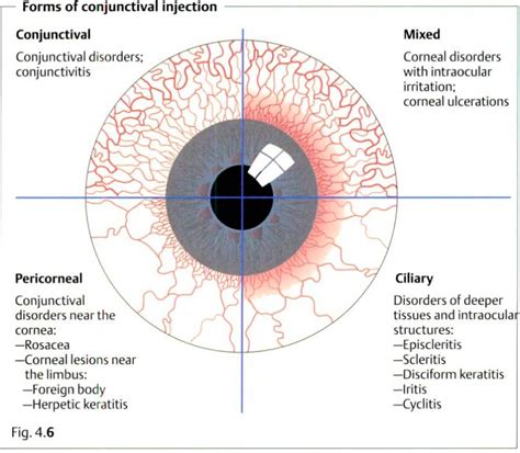 The Red Eye - Critical Care Collaborative