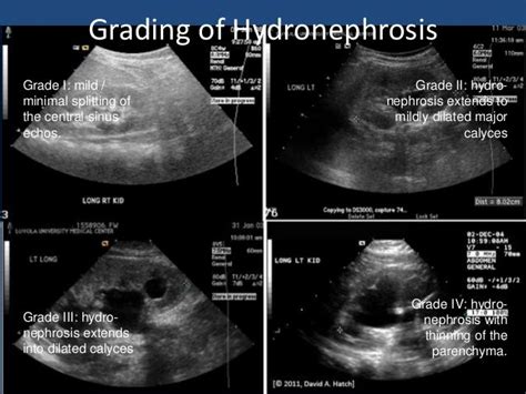 Diagnostic imaging, Ultrasound, Ultrasound tech