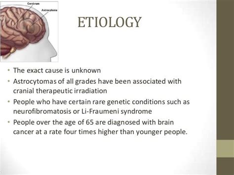 Astrocytoma