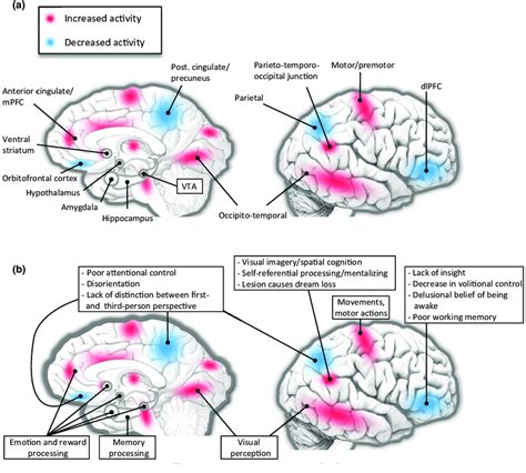 (a) Functional neuroanatomy of REM sleep. Brain regions more activated ...