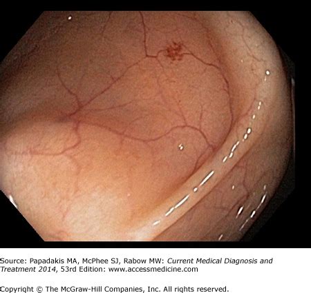 CMDT Media Library | AccessMedicine | McGraw-Hill Medical