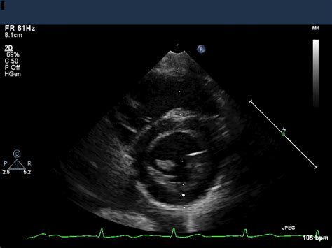 Lesson 4: Two-dimensional (2D), video, and M-mode image acquisition – Echo Physics