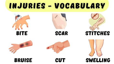 Injuries Vocabulary in English | with examples | Listen and practice - YouTube