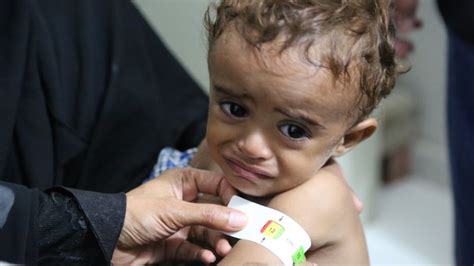 Yemen food crisis leaves millions at risk of starving | CNN