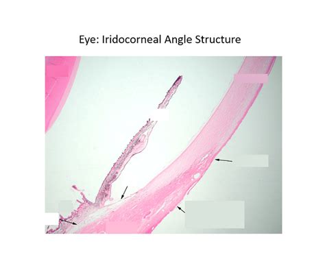 Eye Iridocorneal Angle Anatomy Quiz