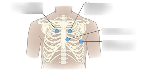 Heart Valve Sounds APT-M 2245 Diagram | Quizlet