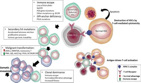 Aplastic Anemia Pathophysiology Diagram